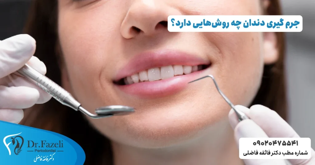 جرم گیری دندان چه روشهایی دارد؟ (روشهای جرم گیری دندان)