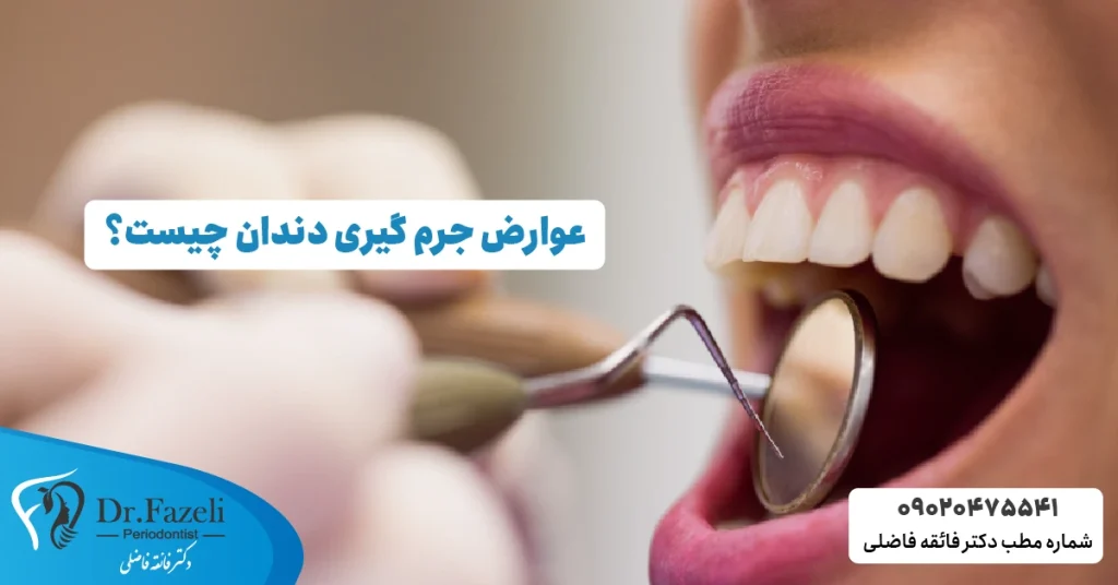 عوارض جرم گیری دندان چیست؟