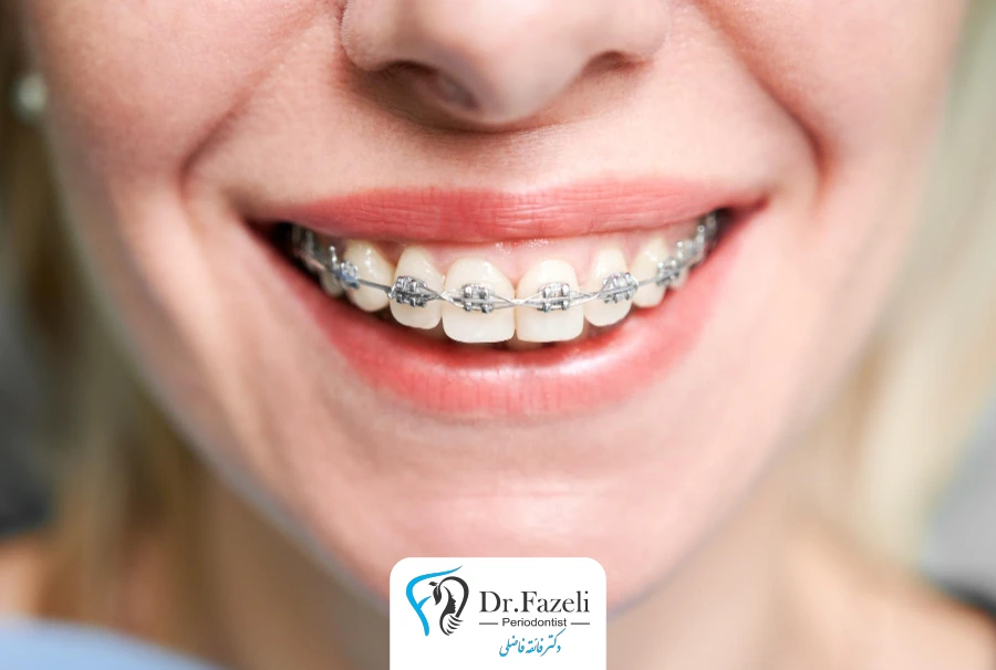 خدمات ارتودنسی دندان