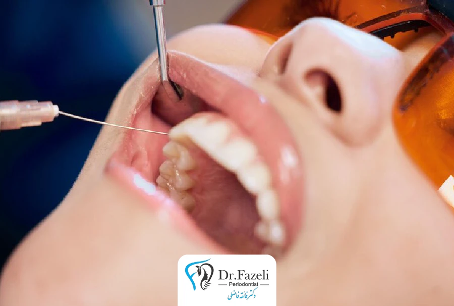 خدمات جراحی لثه