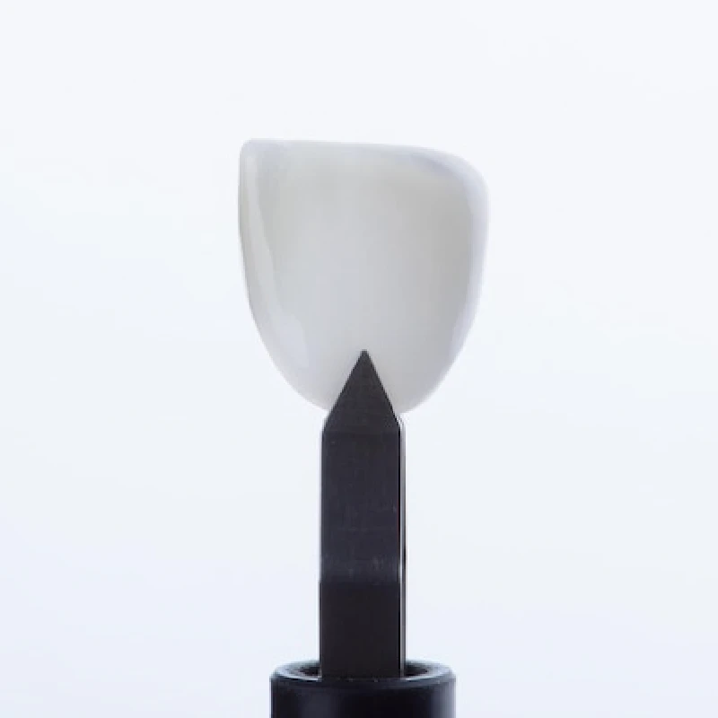 لمینت دندان