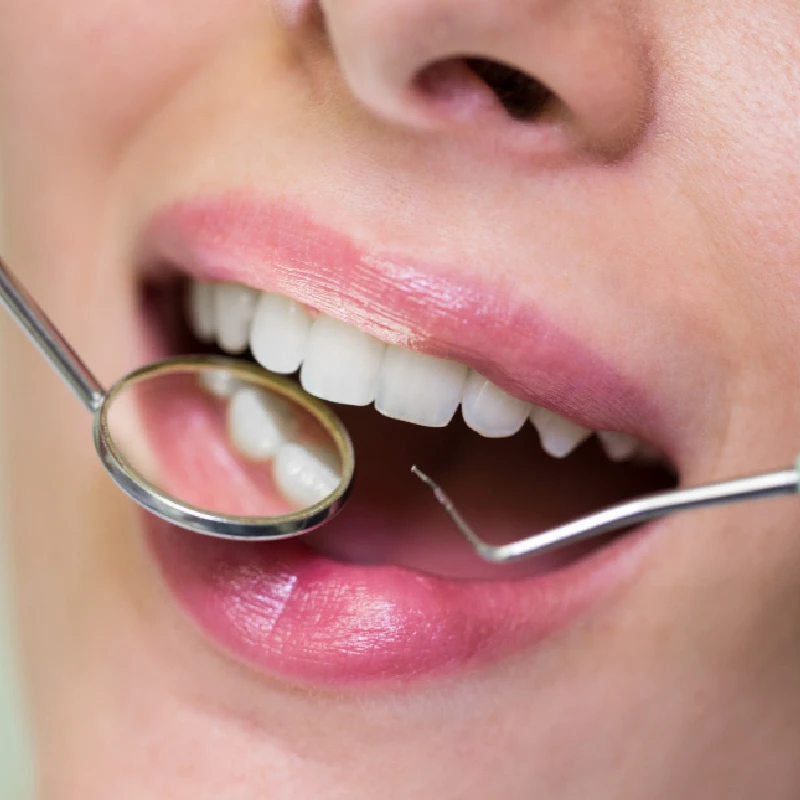 ترمیم دندان