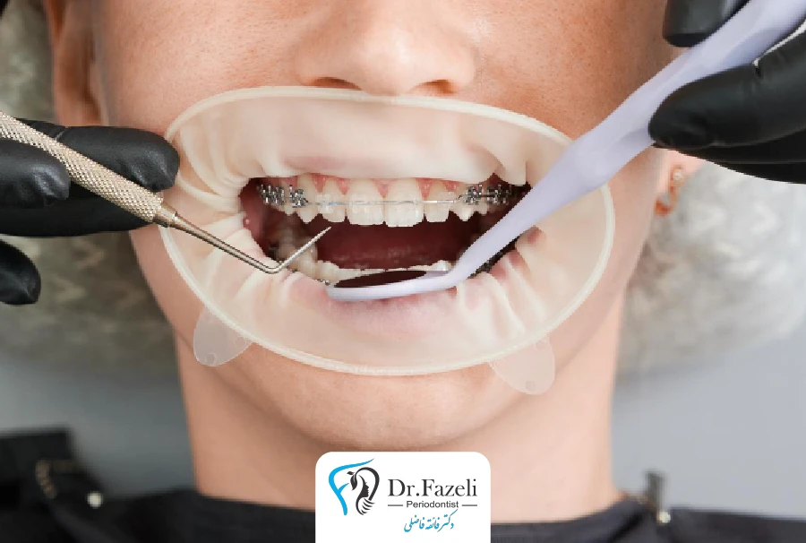 ترمیم دندان