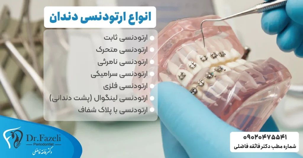 انواع ارتودنسی دندان 🦷