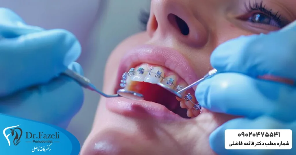 مراحل ارتودنسی دندان